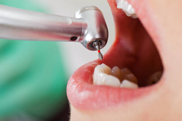 Best Cracked Tooth Emergency Dentist  in Fortville, IN
